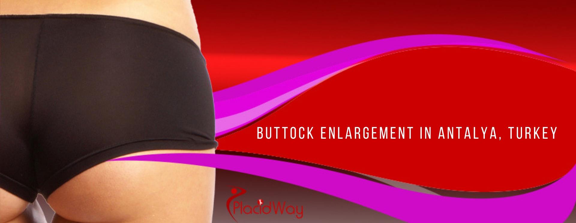 Buttock Enlargement in Antalya, Turkey